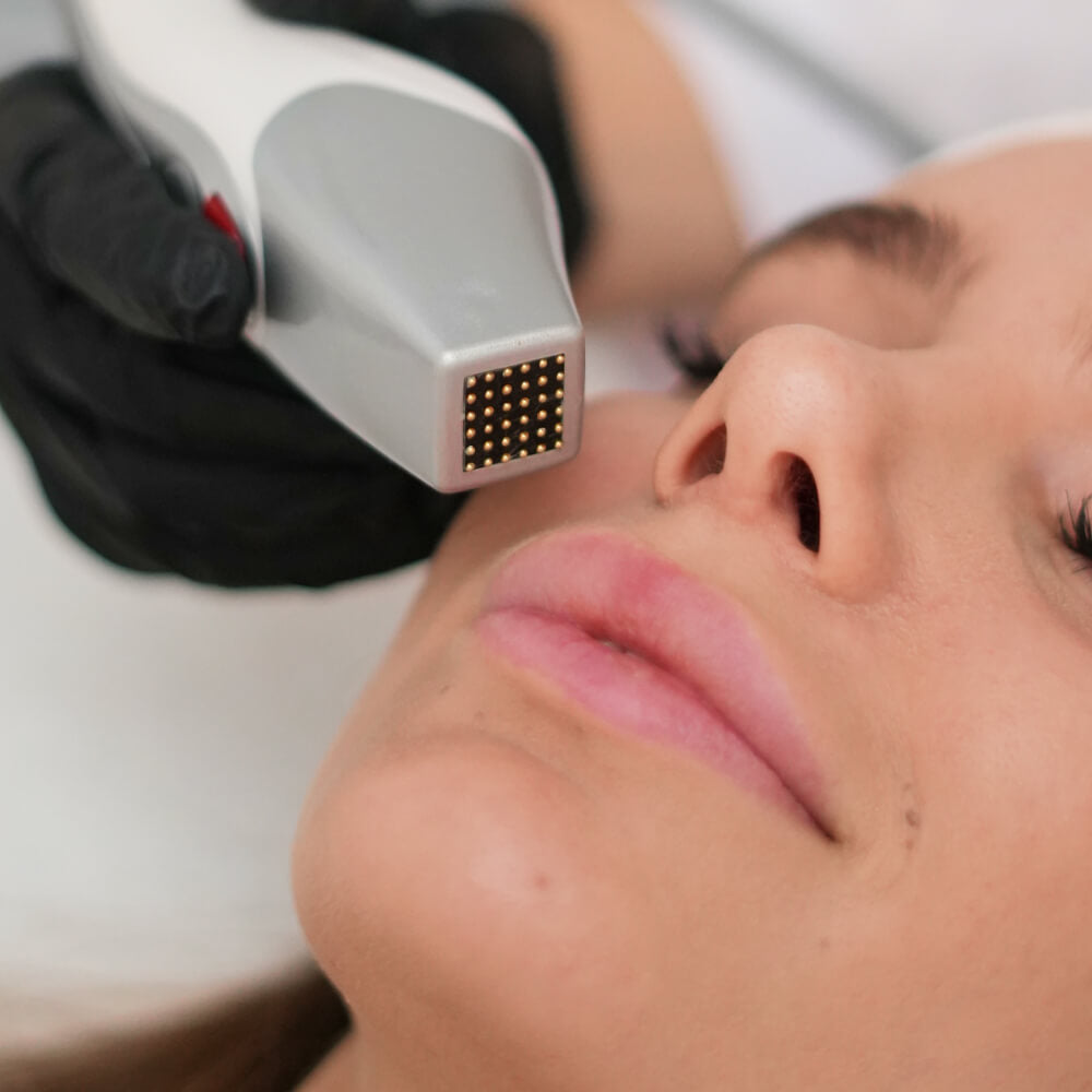 Zemits CrystalFrax Pro MD — treatment