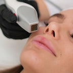 Zemits CrystalFrax Pro MD — treatment