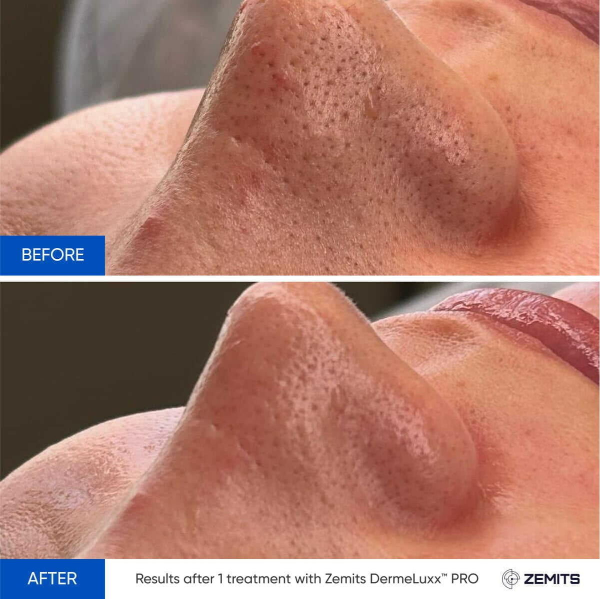 Before After Slide 8