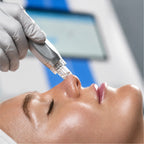 Zemits DermeLuxx Ultra — treatment in progress
