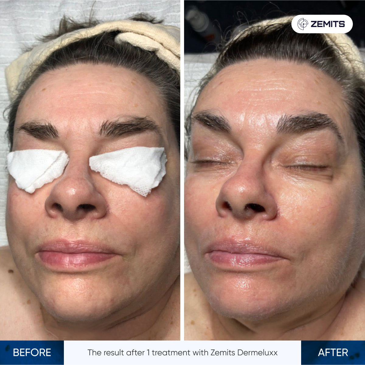 Before After Slide 2