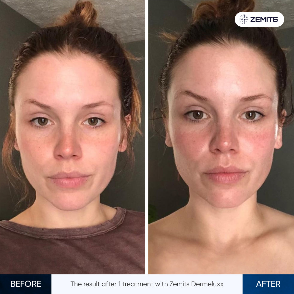 Before After Slide 3