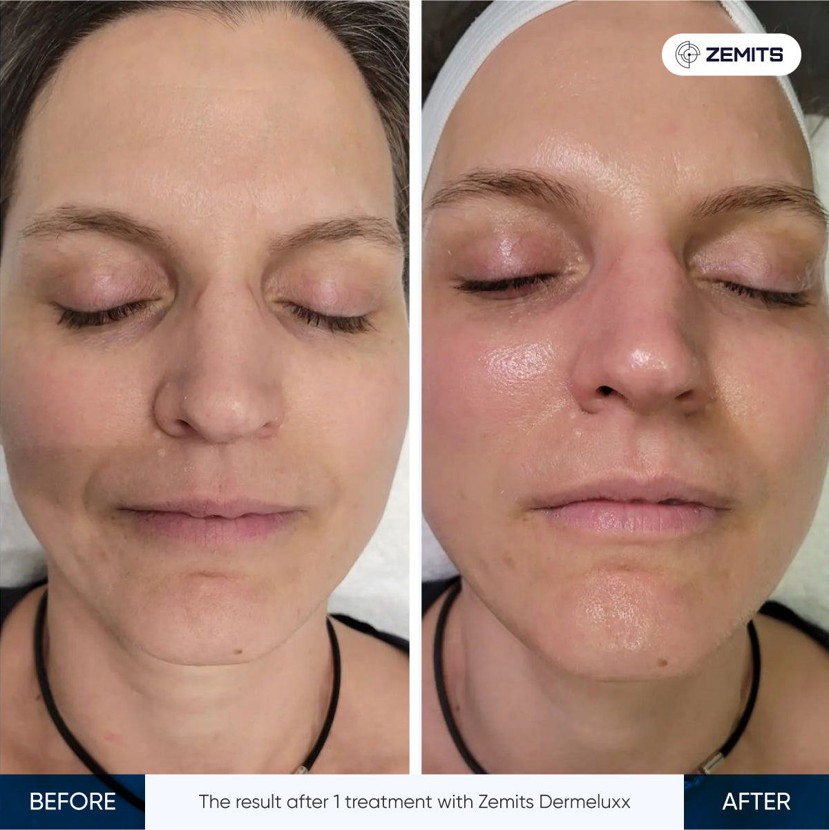 Before After Slide 4