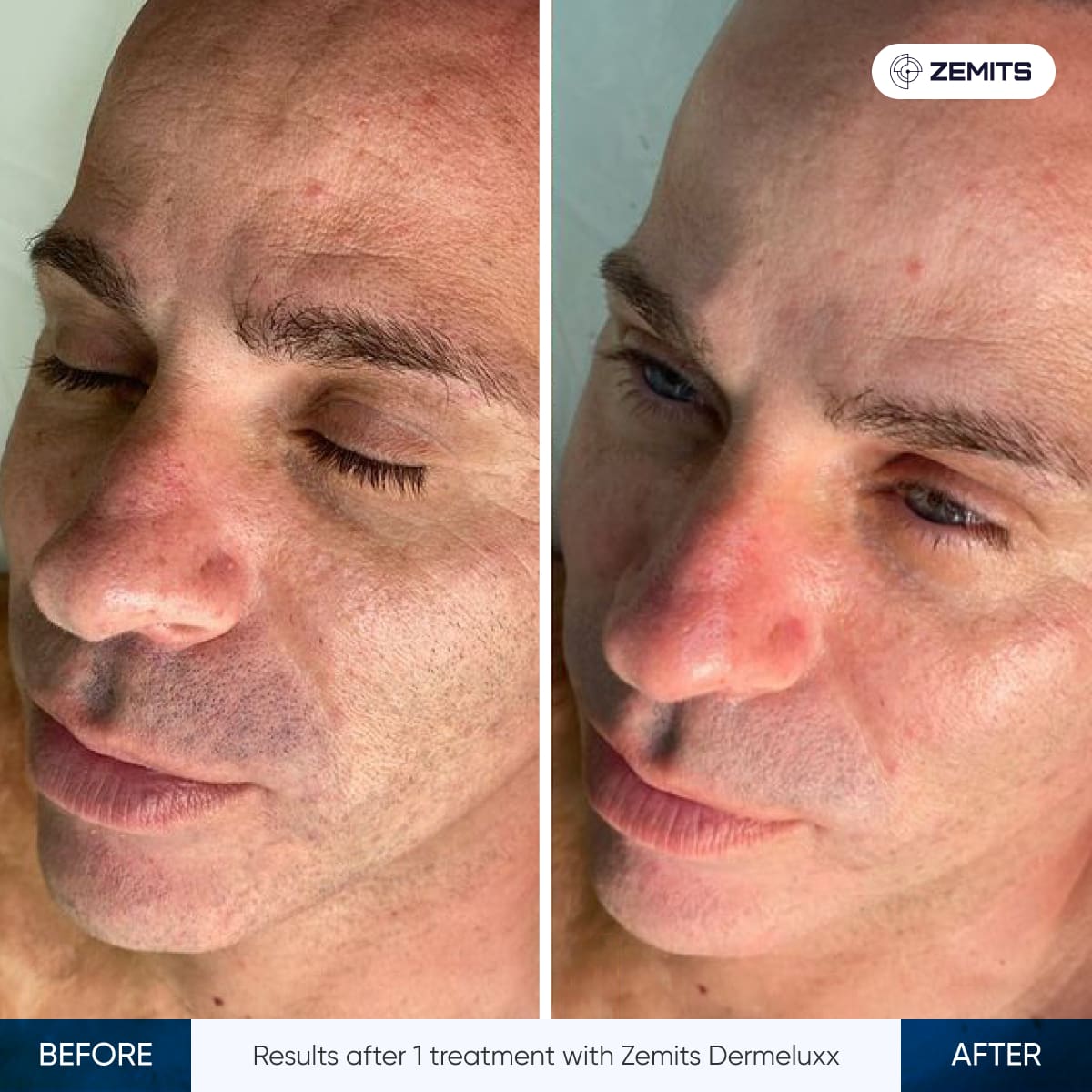 Before After Slide 8