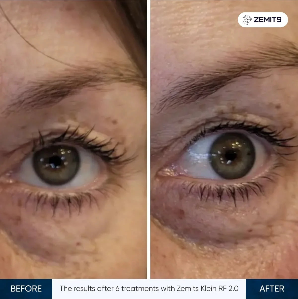 Before After Slide 19