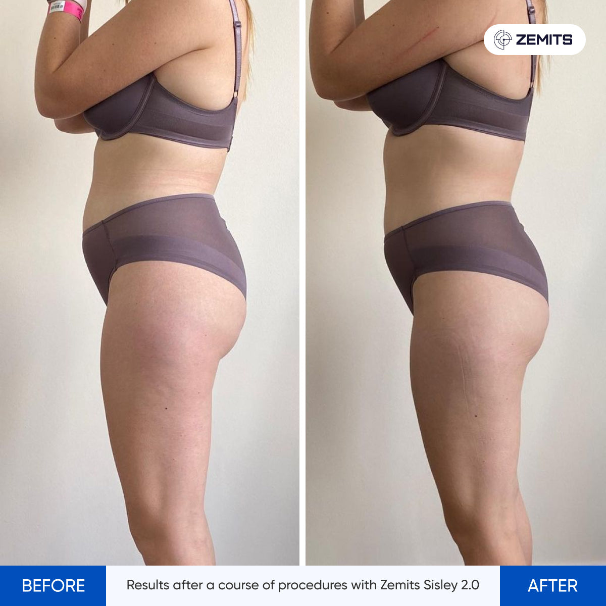 Before After Slide 2