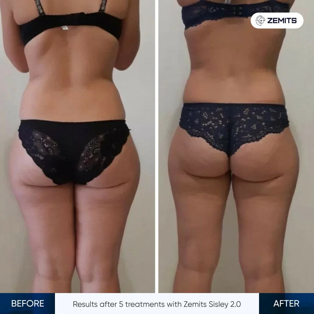 Before After Slide 1
