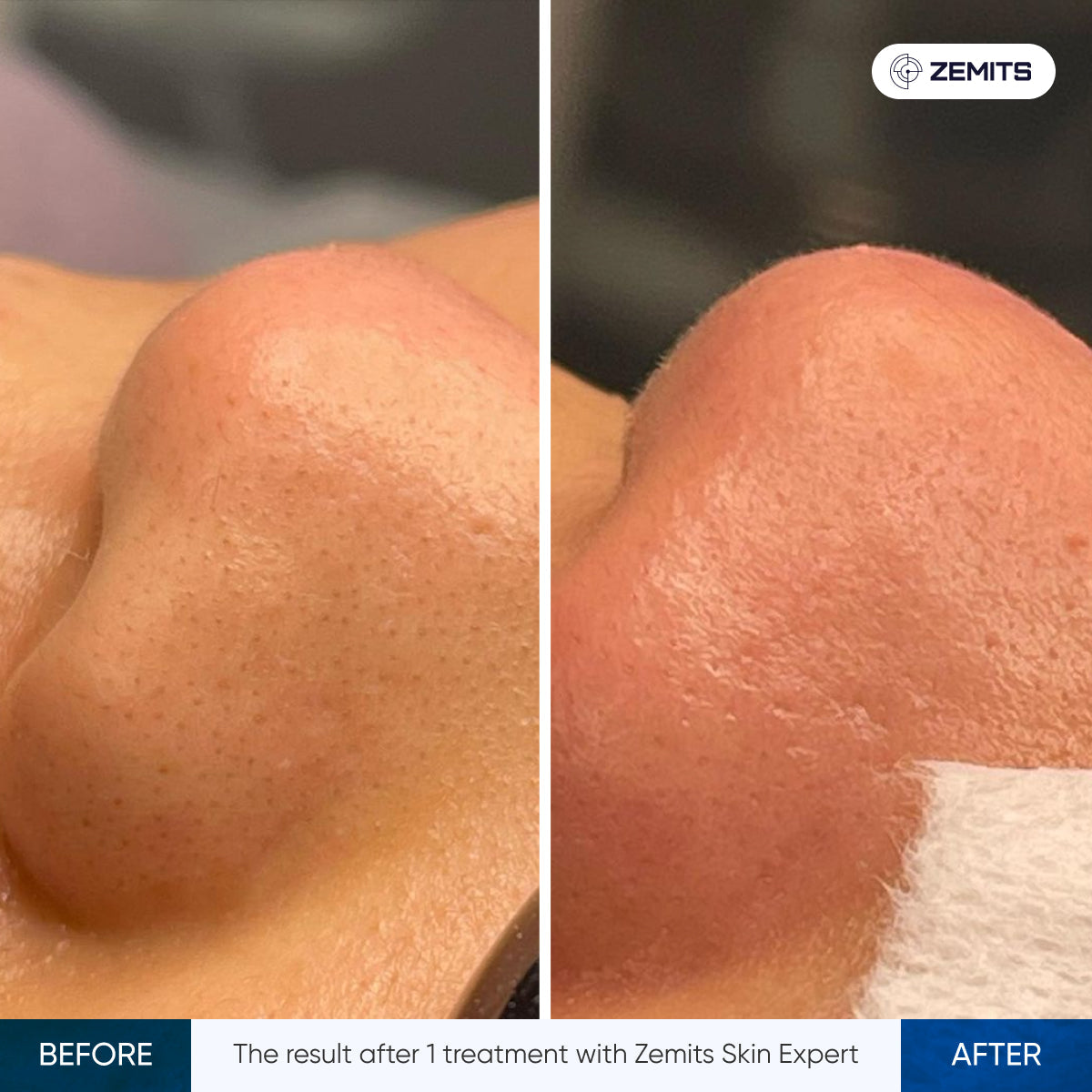 Before After Slide 3