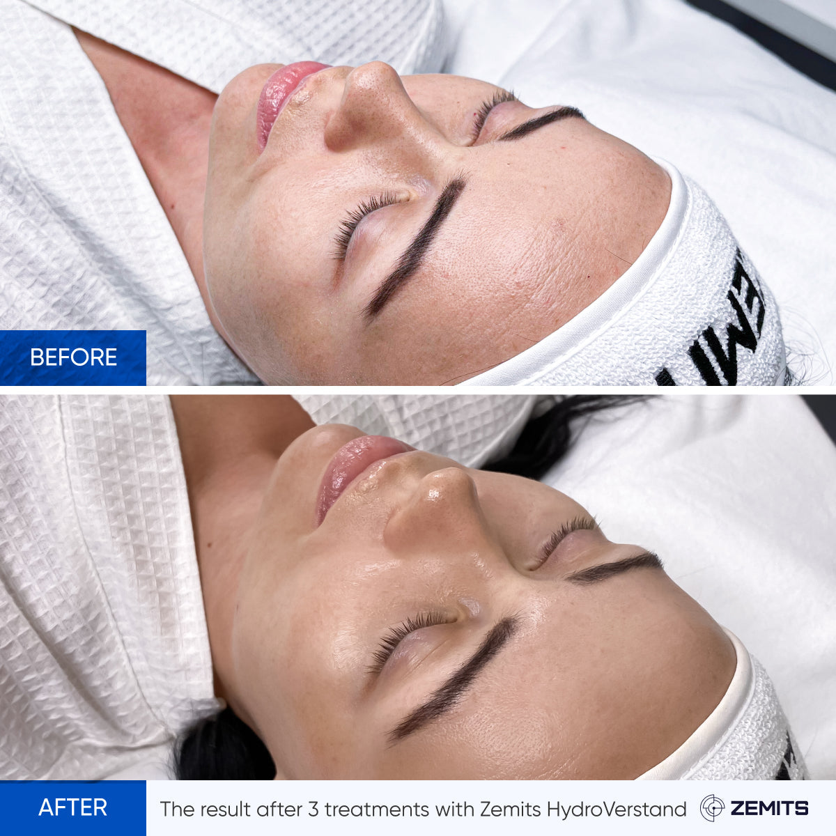 Before After Slide 4