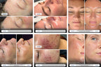Ultimate Skin Renewal Bundle — photo 4