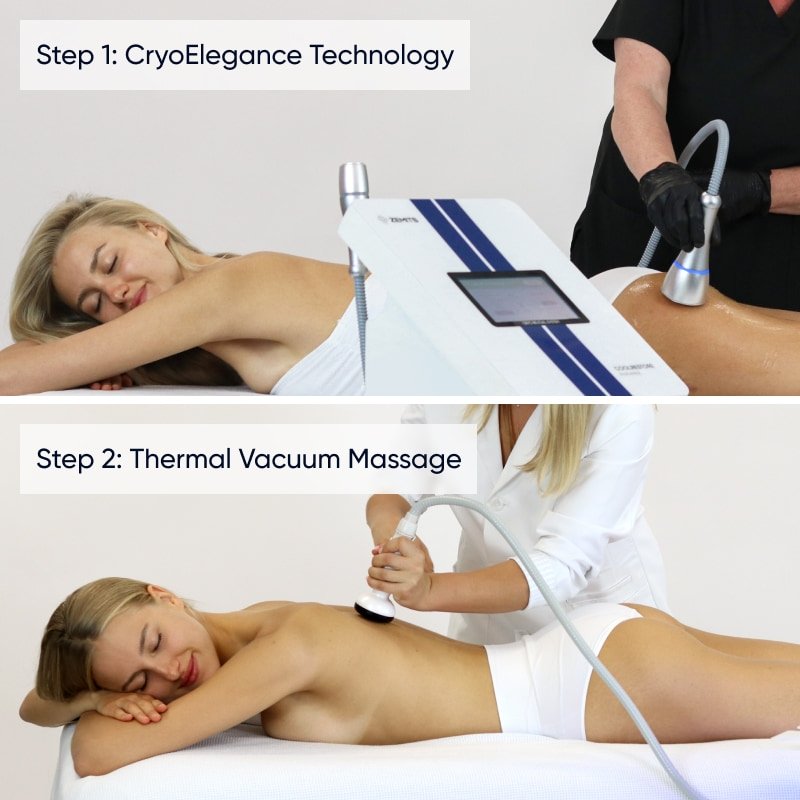 Body Contouring and Skin Rejuvenation Bundle — photo 3