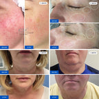 Body Contouring and Skin Rejuvenation Bundle — photo 9