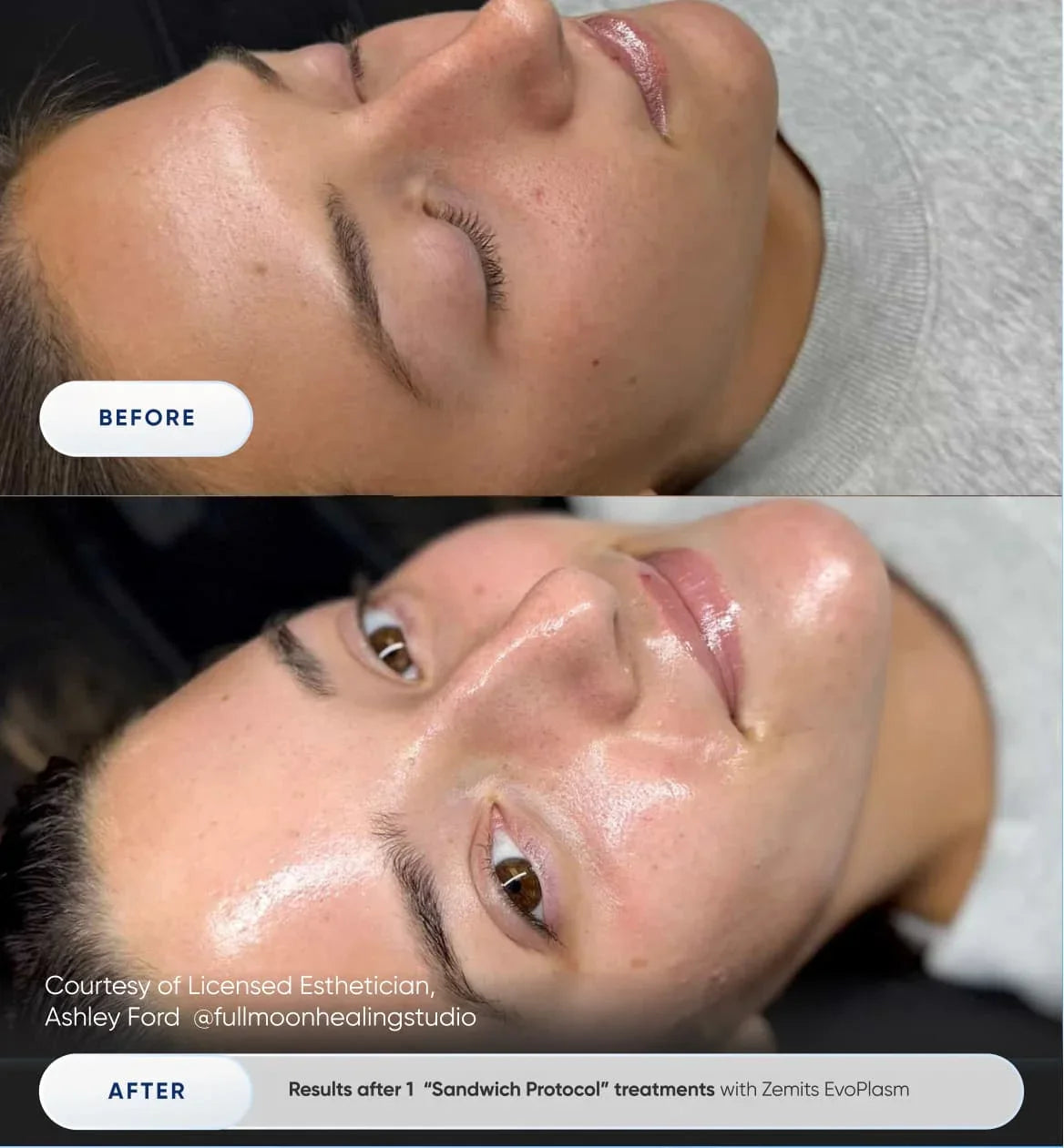 Before After Slide 1