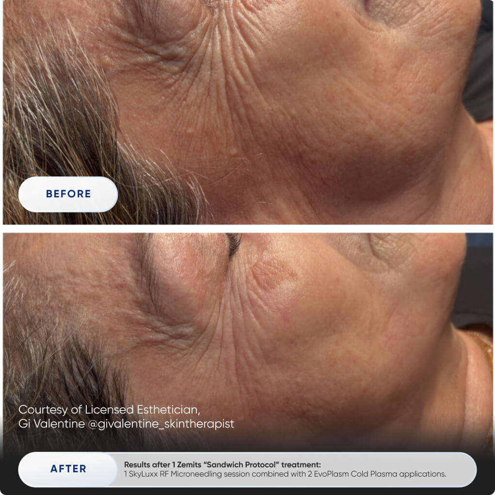 Before After Slide 3
