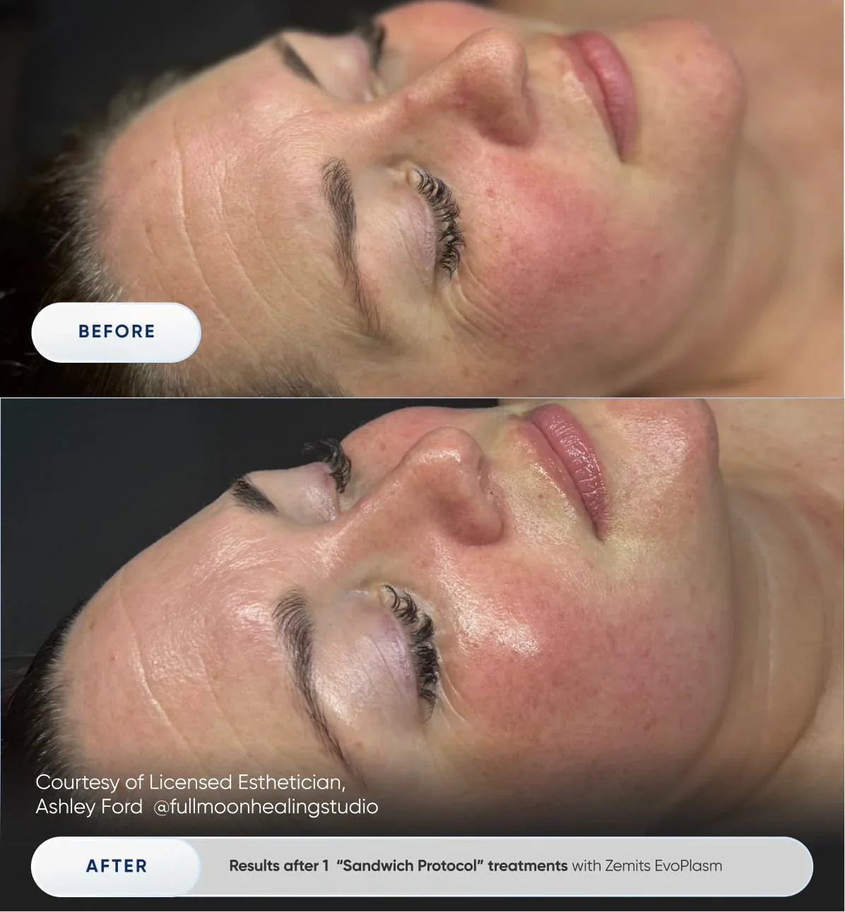 Before After Slide 4