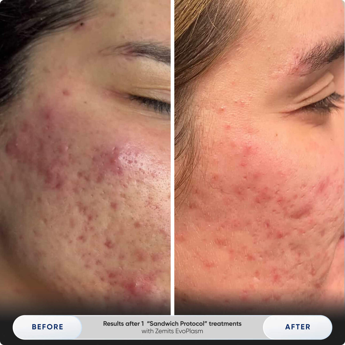 Before After Slide 6