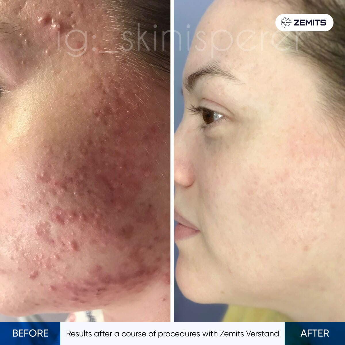 Before After Slide 1