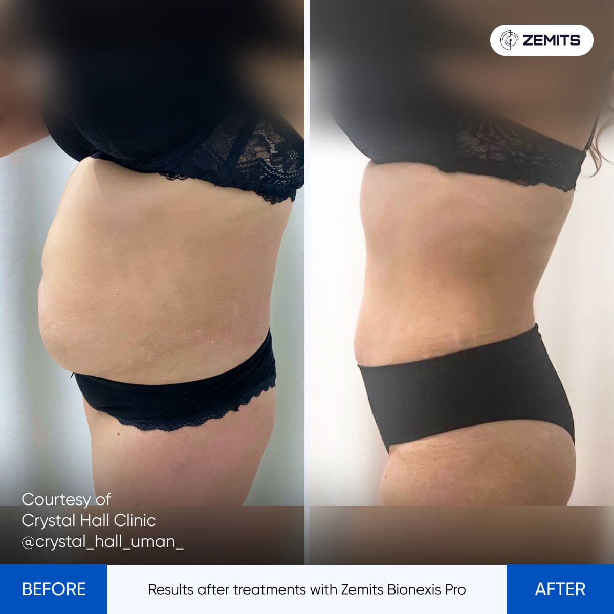 Before After Slide 1