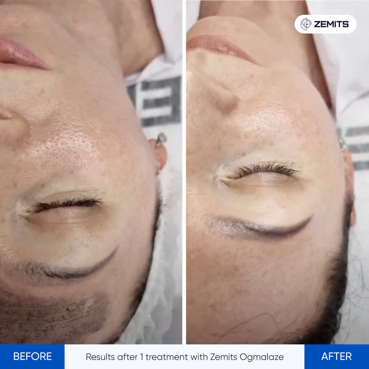 Before After Slide 8