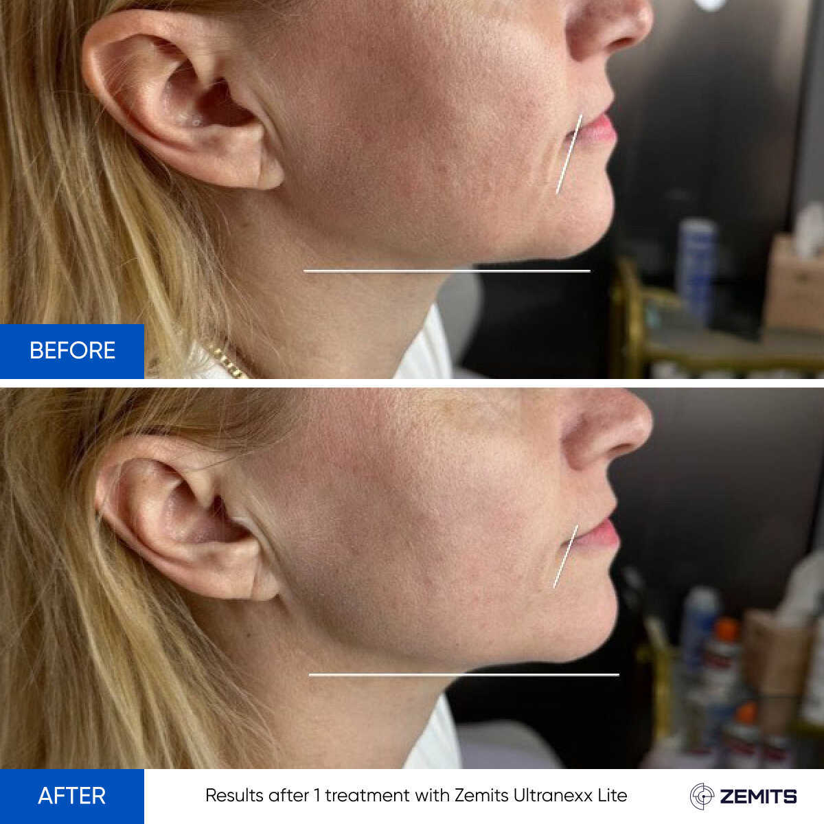Before After Slide 2