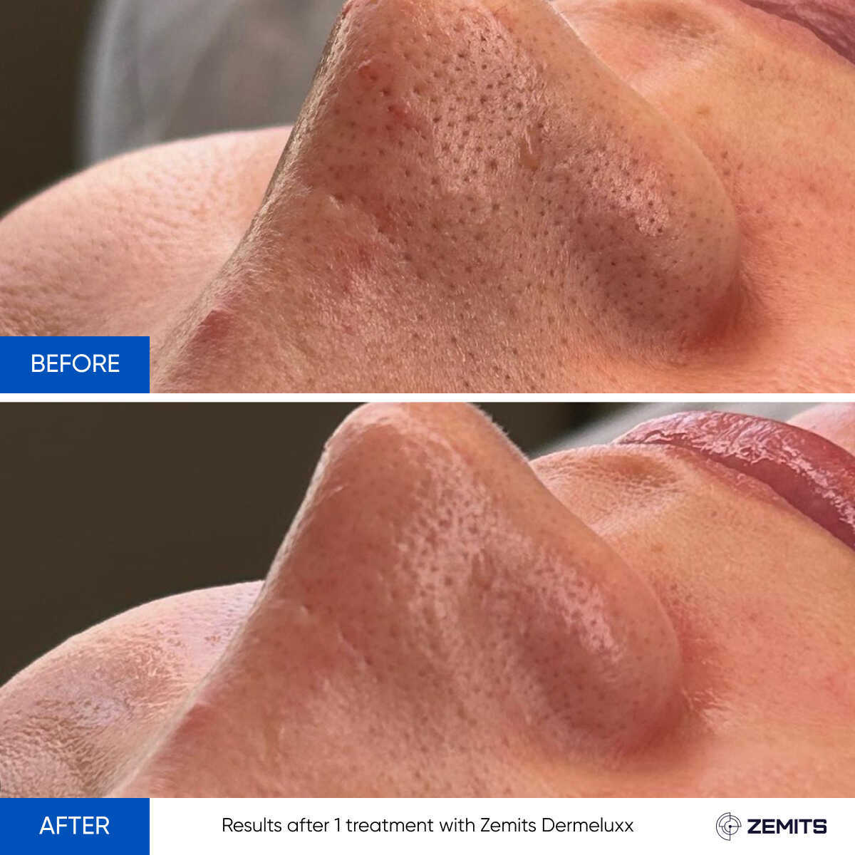 Before After Slide 19