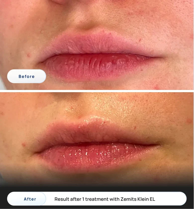 Before After Slide 3