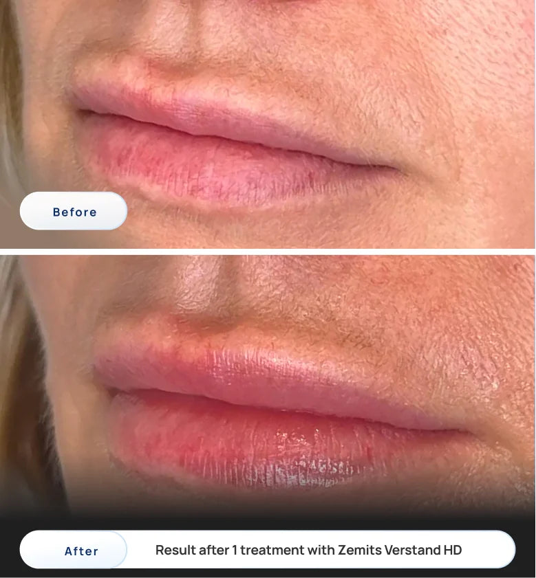 Before After Slide 2