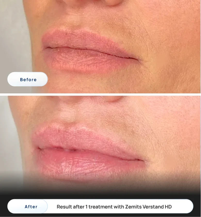 Before After Slide 1