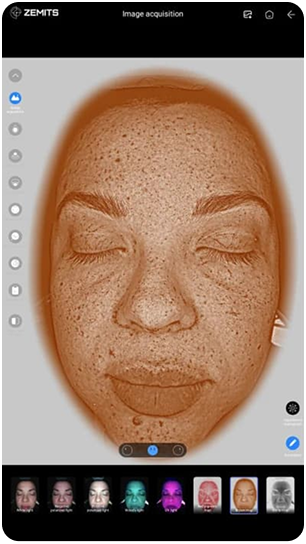 VeraFace Pro brown pigment map analysis view