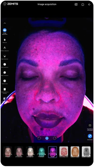 VeraFace Pro UV light analysis view