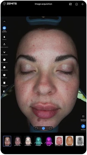 VeraFace Pro white light analysis view of the face