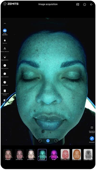 VeraFace Pro Wood's light analysis view